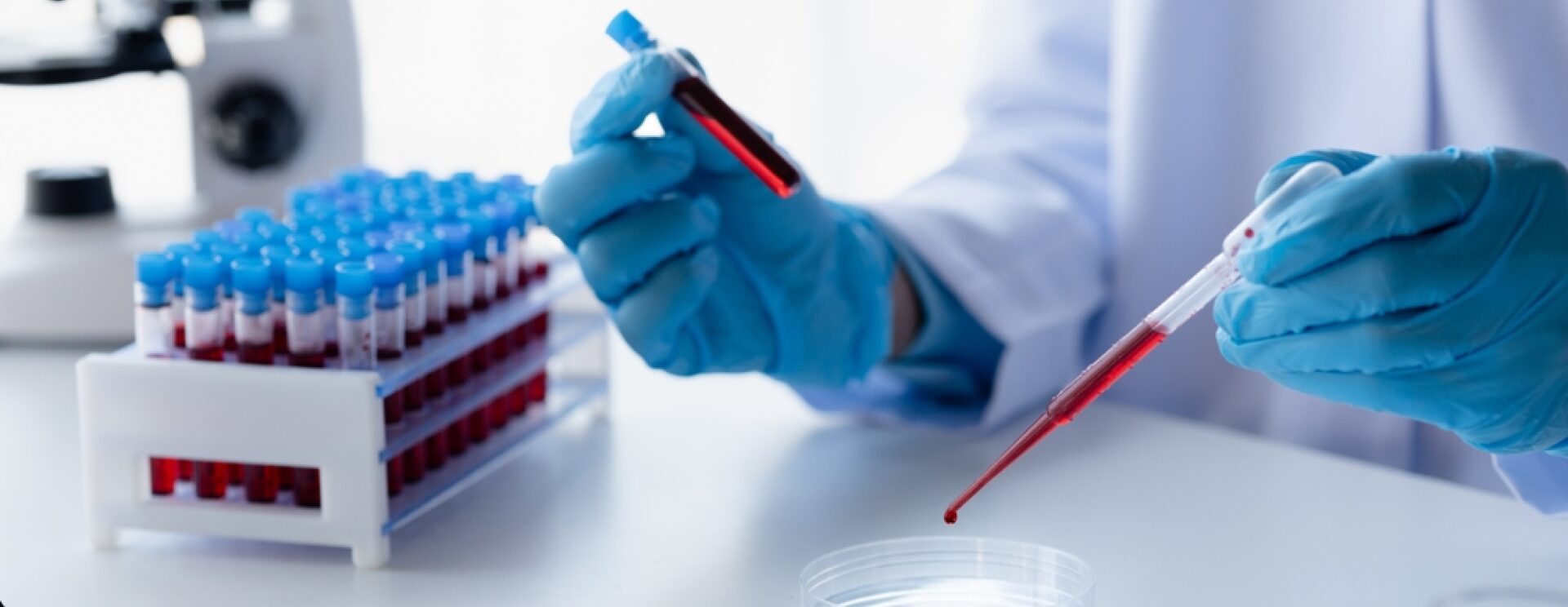 Scientifique manipulant un échantillon de sang en laboratoire, avec des tubes à essai, symbolisant les analyses biologiques.